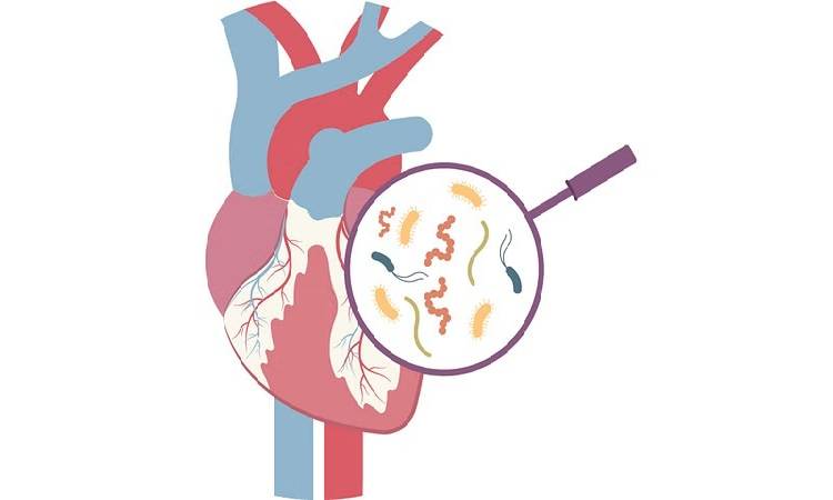 Pune News | Middle-Aged Patient's Life Saved After Complex Heart Procedure in Pune